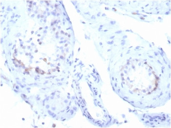 Anti-StAR / Steroidogenic acute regulatory protein, clone STAR/3915R
