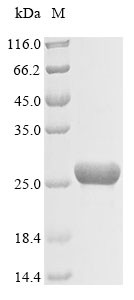 Carbamoyl-phosphate synthase [ammonia], mitochondrial (Cps1),partial, rat, recombinant