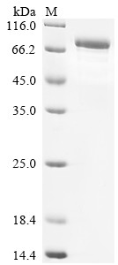 TNFAIP3-interacting protein 1 (TNIP1), human, recombinant