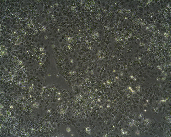 JAR Cells