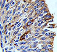 Anti-VTI1A