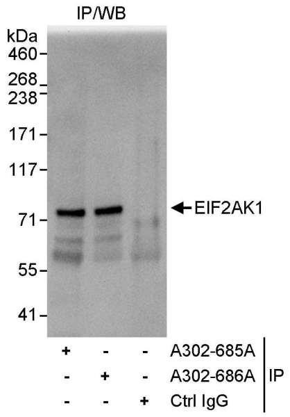 Anti-EIF2AK1