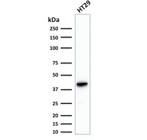 Anti-Cytokeratin 20 / CK20, clone KRT20/1993