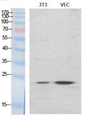 Anti-Ephrin A1