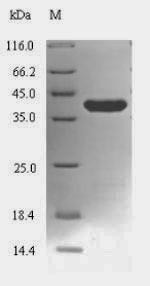 Lon protease (lon), partial, Mycoplasma pneumoniae, recombinant