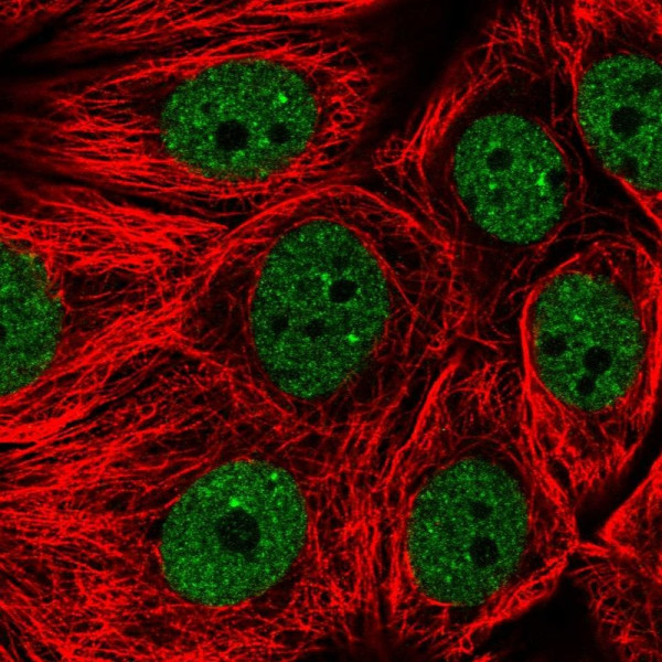 Anti-ENOPH1