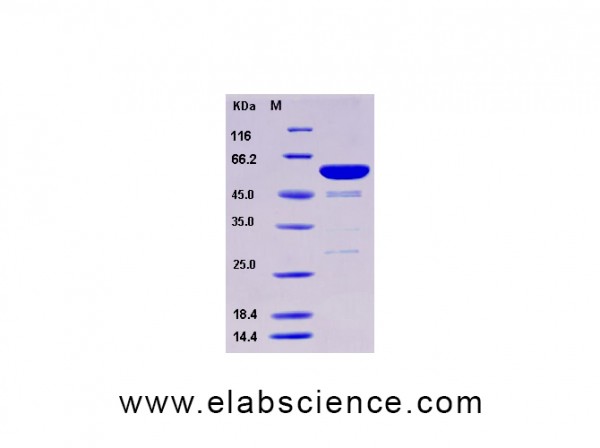 Recombinant Human Galectin-8 / LGALS8 Protein (GST tag)