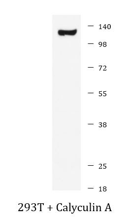 Anti-phospho-SIRT1 (Thr530)
