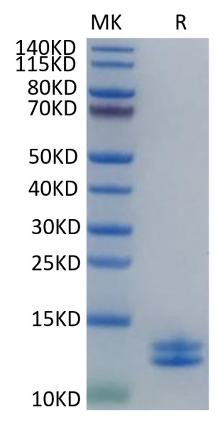 Human Calprotectin (S100A8&amp;S100A9) Protein