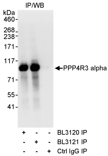 Anti-PPP4R3 Alpha
