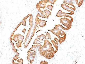 Anti-PSA / Prostate Specific Antigen, clone KLK3/801