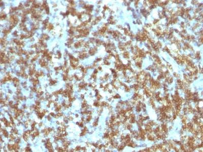 Anti-CD45RO (T-Cell Marker)(Clone: SPM125)