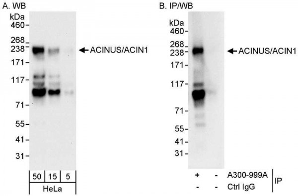 Anti-ACINUS/ACN1