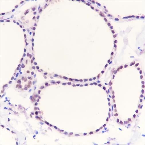 Anti-Recombinant PAX8, clone A323