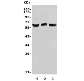 Anti-Arylsulfatase L / ARSL