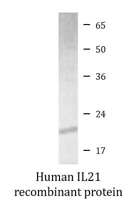 Human IL21 recombinant protein (Active)