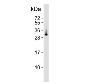 Anti-ELOVL6