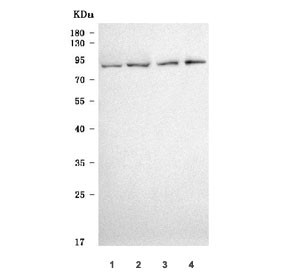 Anti-SCIN / Scinderin