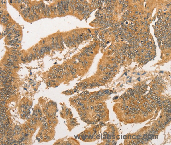 Anti-BCL2L14