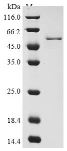 Nucleoprotein (N), human coronavirus OC43, recombinant