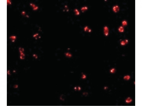 Anti-Integrin alpha 4