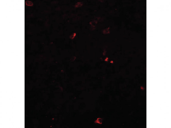 Anti-BCAS3
