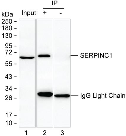 Anti-SERPINC1