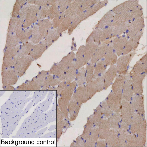 Anti-PIK3C3