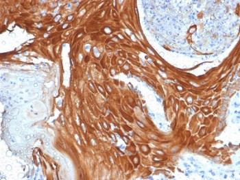 Anti-Keratin 6 / Cytokeratin 6, clone KRT6A/2368