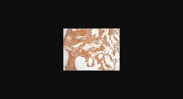 Anti-CK16, monoclonal