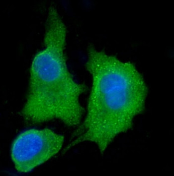 Anti-ALDH3A1