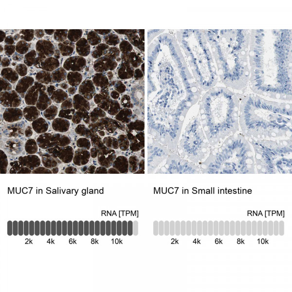Anti-MUC7