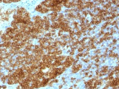 Anti-CD45RA (Leucocyte Marker)(Clone: SPM568)