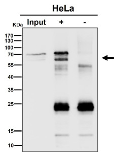 Anti-PPP2R5D / Protein phosphatase 2 regulatory subunit B delta, clone 30P07