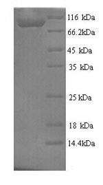 Microtubule-associated protein tau (Mapt), rat, recombinant