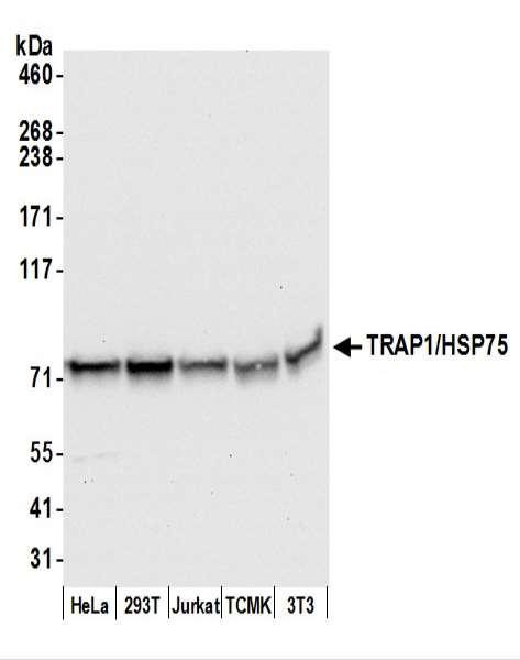 Anti-TRAP1/HSP75