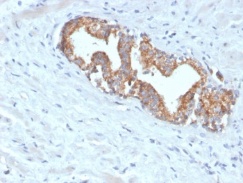 Anti-AMACR / p504S (Prostate Cancer Marker), clone AMACR/4572R