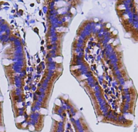 Anti-phospho-MLKL (Ser345)