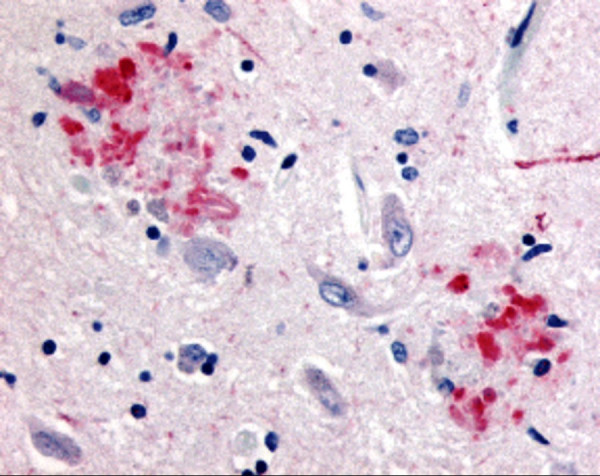 Anti-Amyloid Precursor Protein