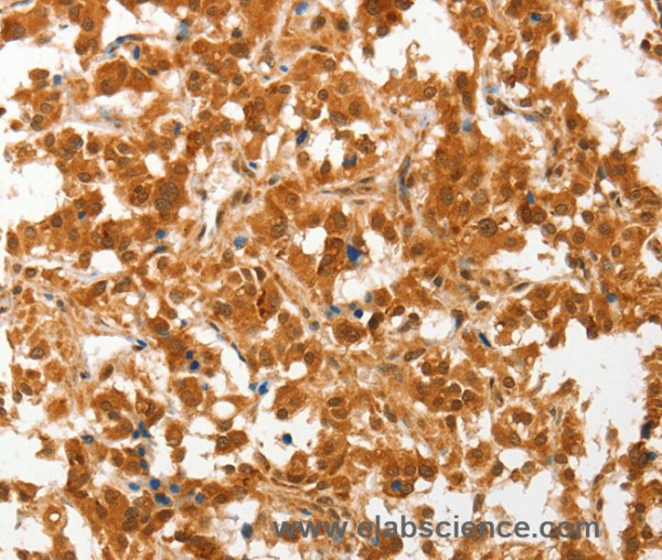 Anti-COL4A3BP