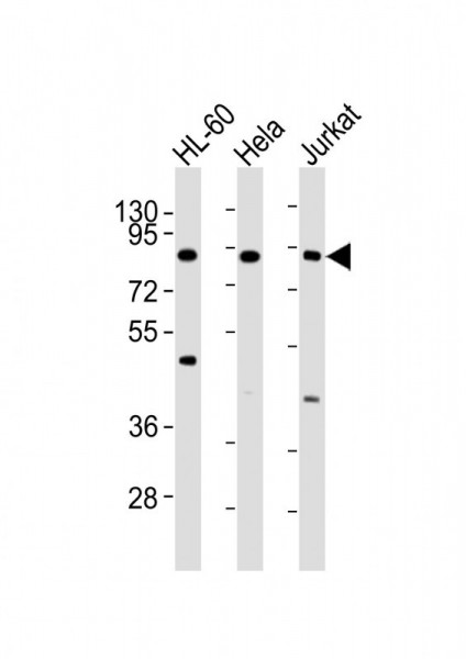 Anti-IKK beta, clone 62AT216