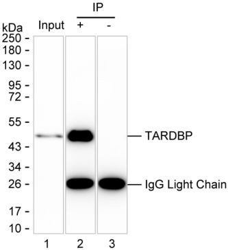 Anti-TDP-25 / TDP-35 / TDP-43