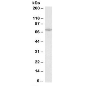 Anti-SLC6A8