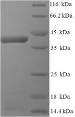 Major surface glycoprotein G (G), partial, human respiratory syncytial virus A, recombinant