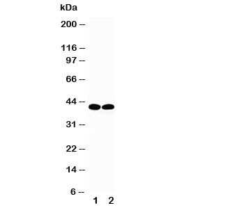 Anti-TBP TATA Binding Protein