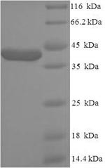 ATP-sensitive inward rectifier potassium channel 10 (KCNJ10), partial, human, recombinant