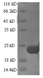 Trypsin inhibitor DE-3, Erythrina caffra, recombinant
