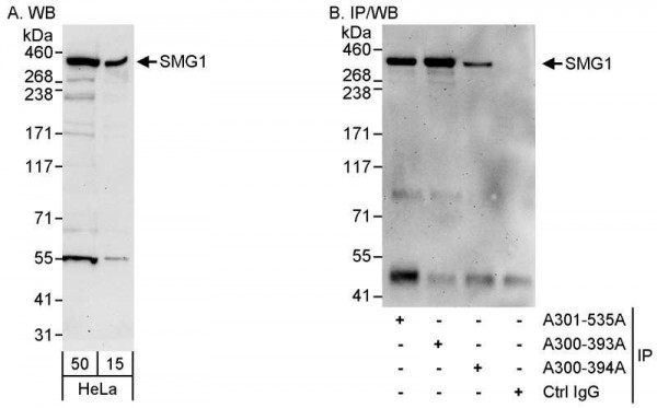 Anti-SMG1