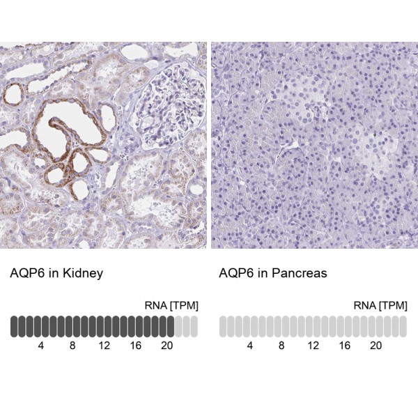 Anti-AQP6