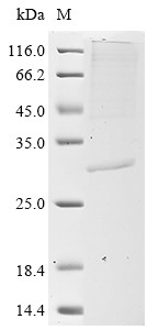 COMM domain-containing protein 5 (COMMD5), human, recombinant